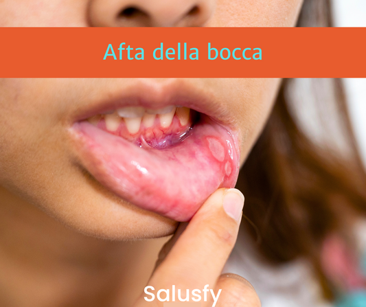 Afta della bocca