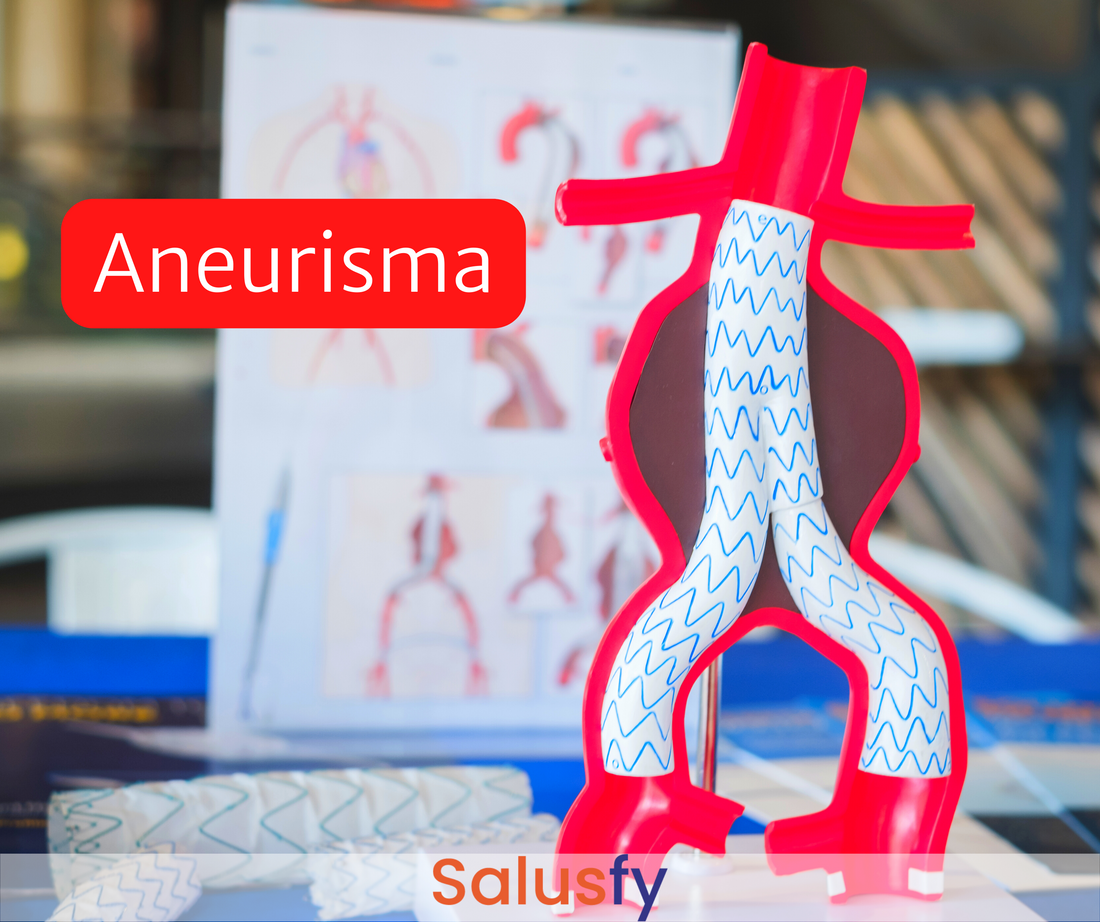 Aneurisma
