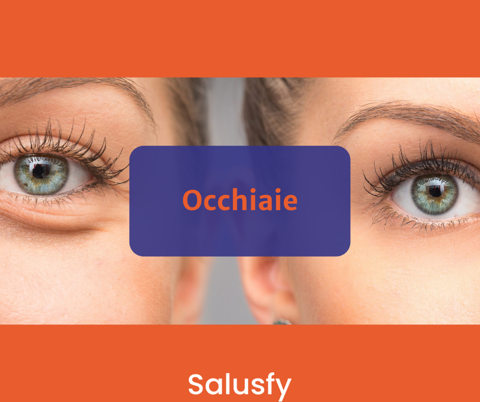 Occhiaie: 8 integratori veramente incredibili per liberartene!